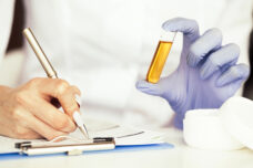 Organic Acids and N.A.D+ Test