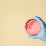 Staphylococci - Nasopharyngeal - Bacterial & Fungal Culture (formerly MARCONs) Test
