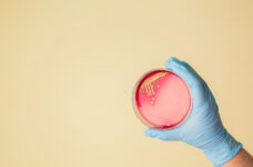 Staphylococci - Nasopharyngeal - Bacterial & Fungal Culture (formerly MARCONs) Test