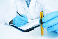 Urine Elements Test