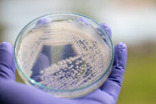 Nasopharyngeal Bacterial Culture (formerly MARCONs) test
