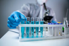 Anti-Cardiolipin Antibodies test