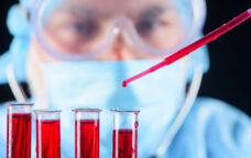 CAMBISeq - Cancer Analysis Mutational Burden and Instability Sequencing provides Next $5,500.00 14 days Generation Sequencing analysis on both DNA and RNA to help predict a patient's response to immunotherapy and to detect genetic variants in over 500 genes.