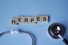 Herpes Simplex Virus
