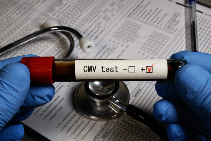 Cytomegalovirus test
